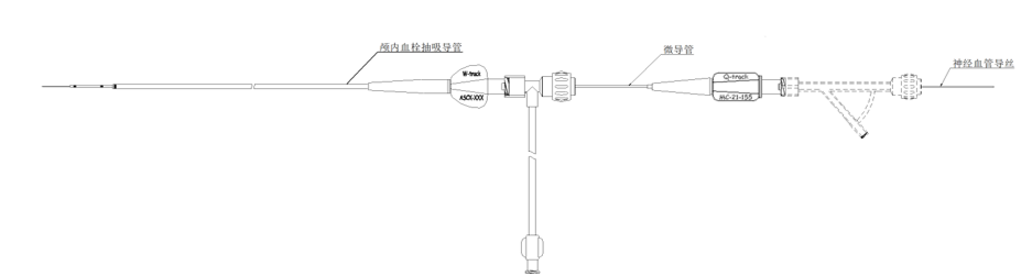 抽吸型取栓协同系统